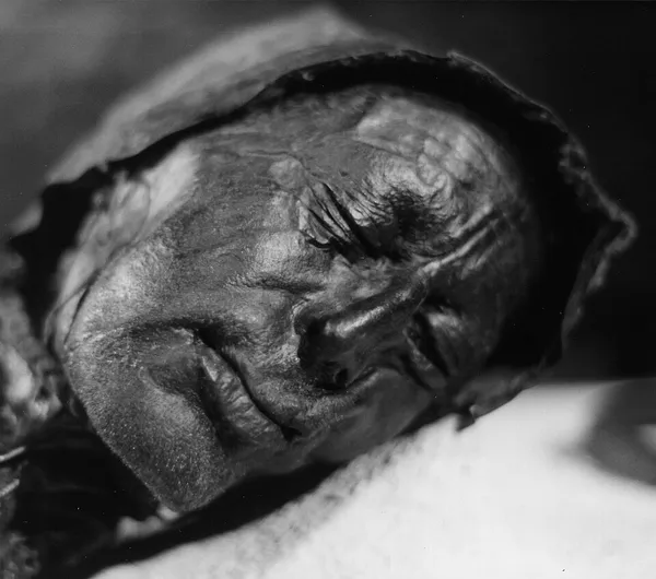 Bog body