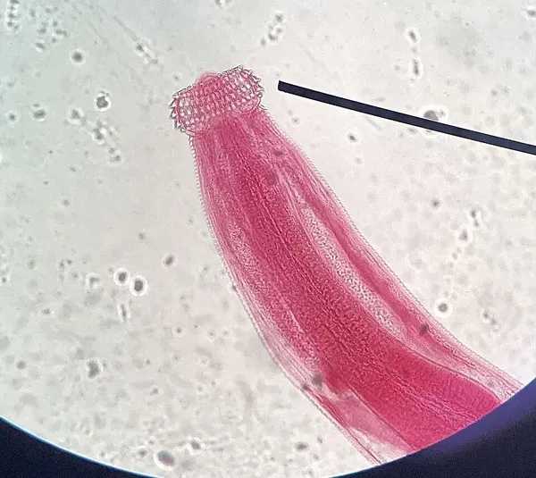 Gnathostoma