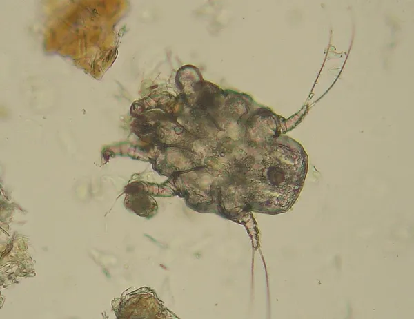 Astigmatina