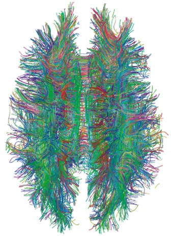 Connectome