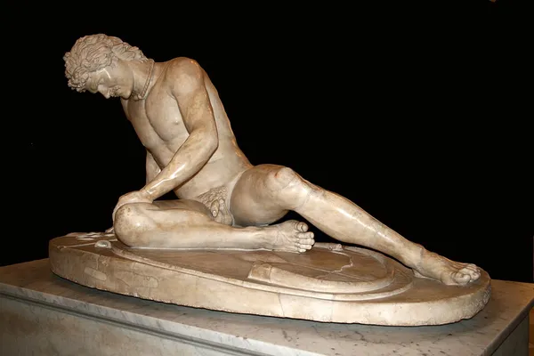 Dying Gaul