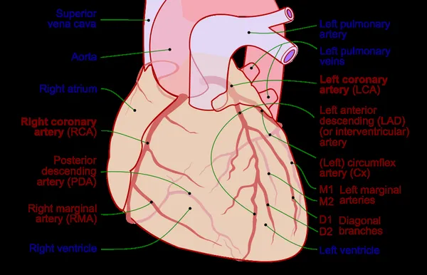 Coronary ischemia