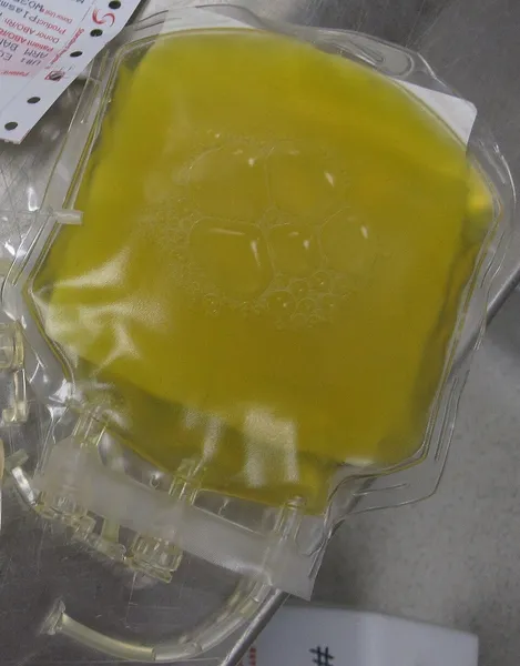 Blood plasma