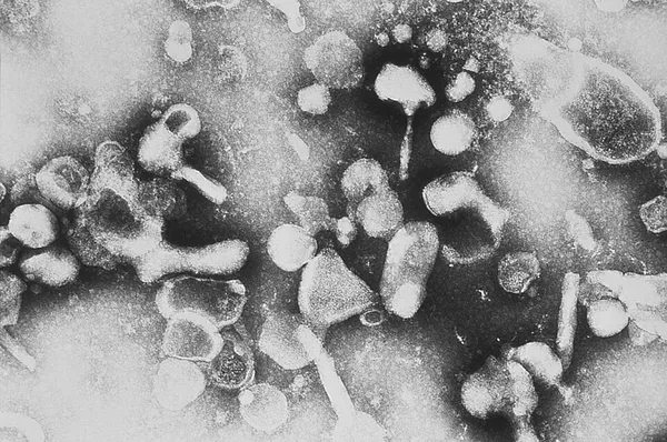 Gammaretrovirus