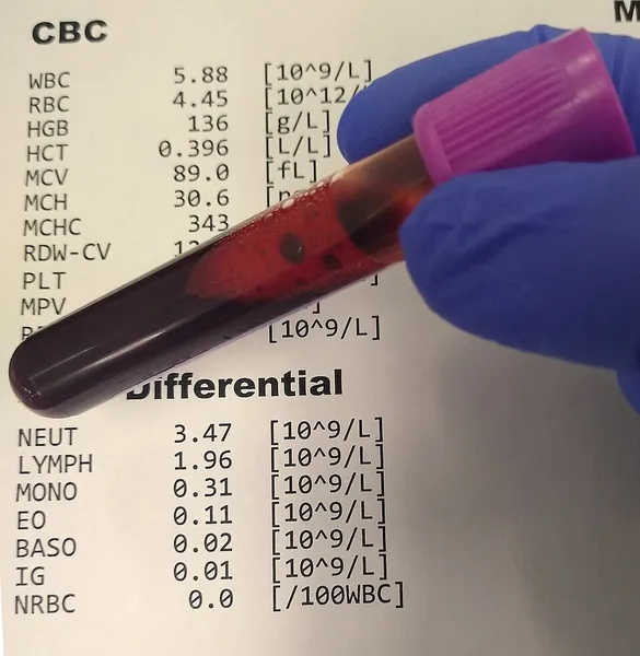 Complete blood count