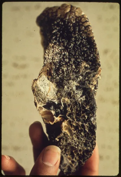Black lung disease