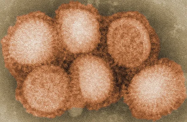 Equine influenza