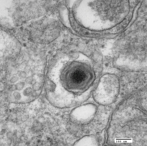 African swine fever virus