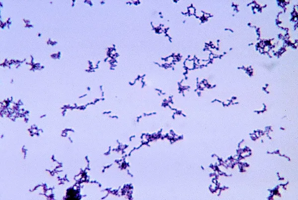 Cutibacterium acnes