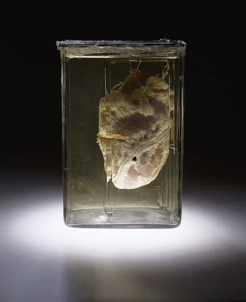 Forensic pathology