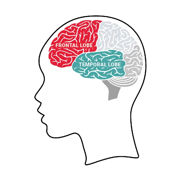 Frontotemporal dementia