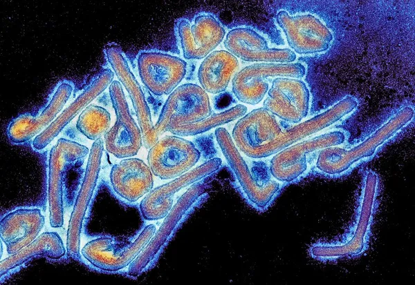 2022 Ghana Marburg virus disease outbreak