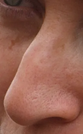Human nose
